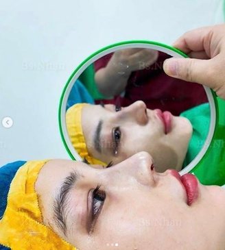 Slider image (4) Dr. Nhan Ho Aesthetics and Plastic Surgery